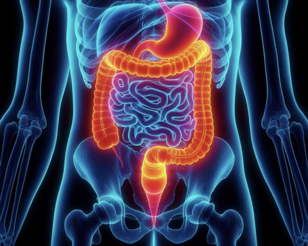 Paksusuolen syöpä - kotitesti